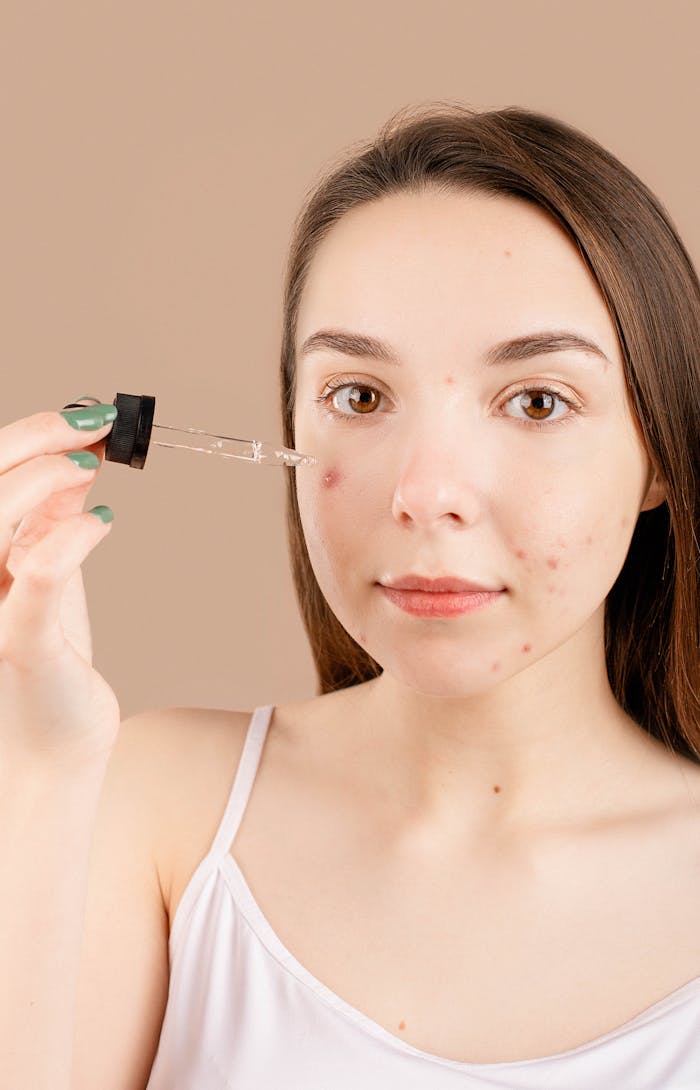 A young woman in a studio applying skincare serum to her face for acne treatment.